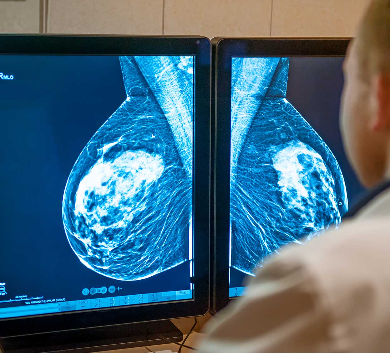 Laudo Online de Mamografia | Telepacs Diagnóstico por Imagem