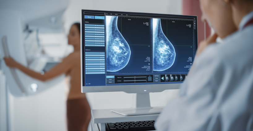 O papel dos serviços de saúde na detecção e tratamento do câncer de mama