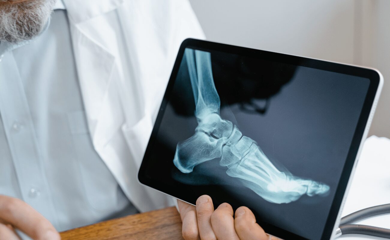 radiologia digital