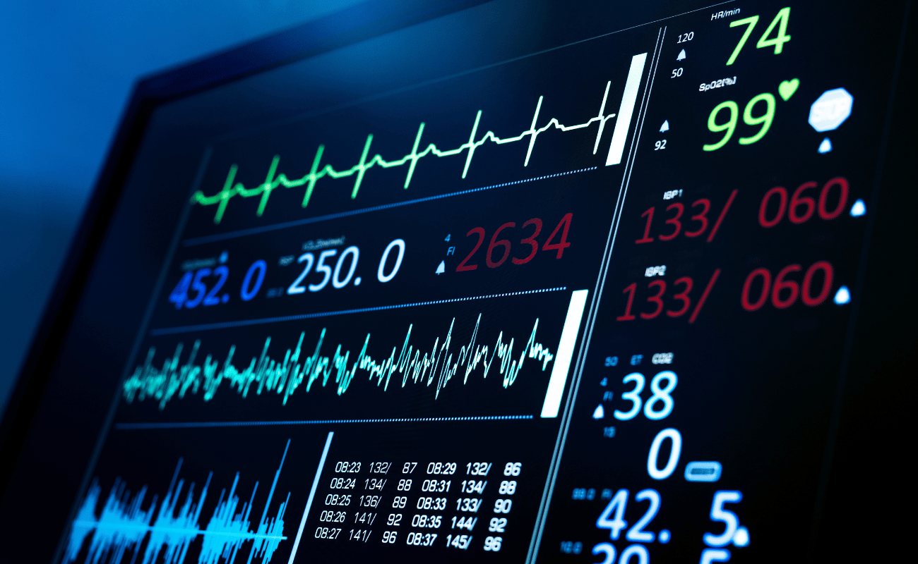 ECG à distância