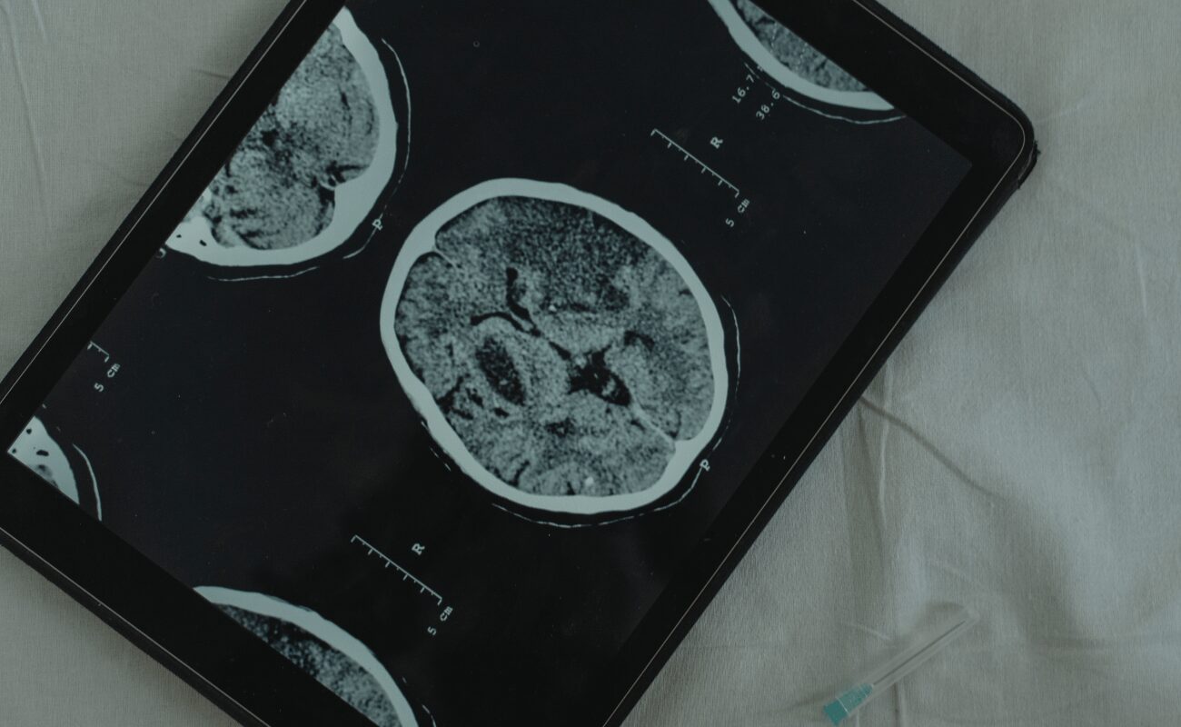 radiologia digital