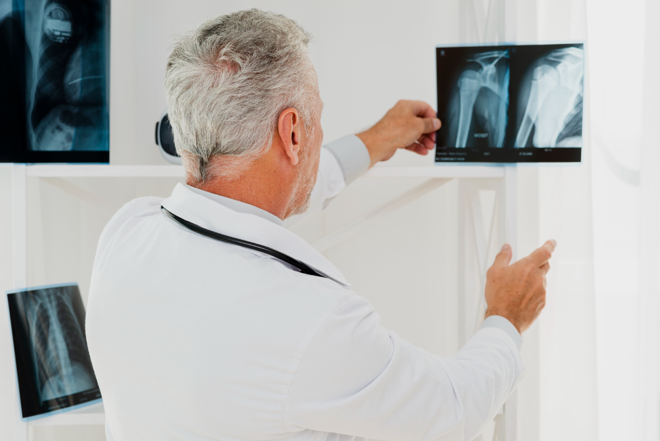 achados críticos em radiologia