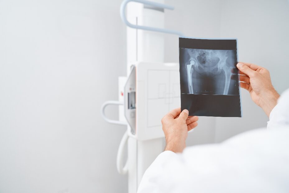 fila de trabalho em radiologia