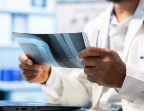 Por que o PACS Local pode ser a escolha mais segura para certas regiões?