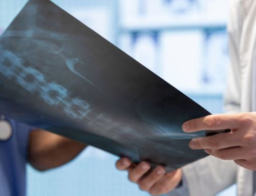 Radiologia inteligente: como a integração sistêmica da Telepacs elimina erros e otimiza processos