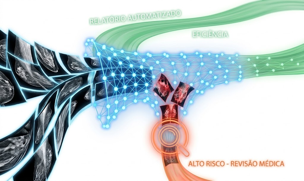 Uma ilustração digital conceitual e moderna, com fundo branco, mostrando o fluxo de processamento de mamografias por Inteligência Artificial. À esquerda, um conjunto de múltiplas imagens de mamografia flui para o centro, onde são filtradas por uma complexa rede neural geométrica de cor azul brilhante. Após o processamento pela rede, o fluxo se divide em dois caminhos. O caminho superior é um feixe verde suave com o texto branco "RELATÓRIO AUTOMATIZADO" e "EFICIÊNCIA", simbolizando casos normais. O caminho inferior é um feixe laranja e vermelho, onde quatro imagens específicas são destacadas com quadros vermelhos e coloração vermelha interna, indicando anomalias. Estas imagens marcadas passam por uma lente de aumento laranja e o texto laranja abaixo diz "ALTO RISCO - REVISÃO MÉDICA", indicando a detecção de uma anormalidade que requer atenção médica humana.