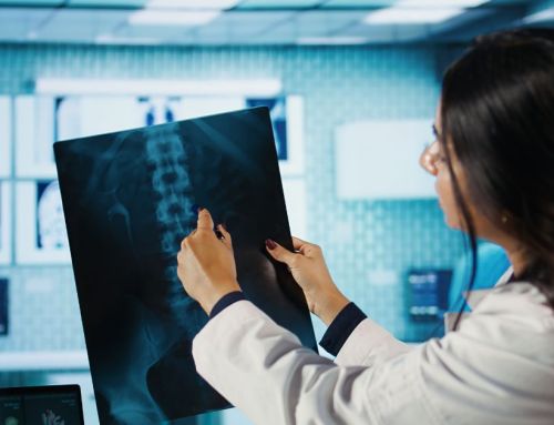Escassez de radiologistas? Como a tecnologia ajuda na retenção de talentos e otimização de escalas