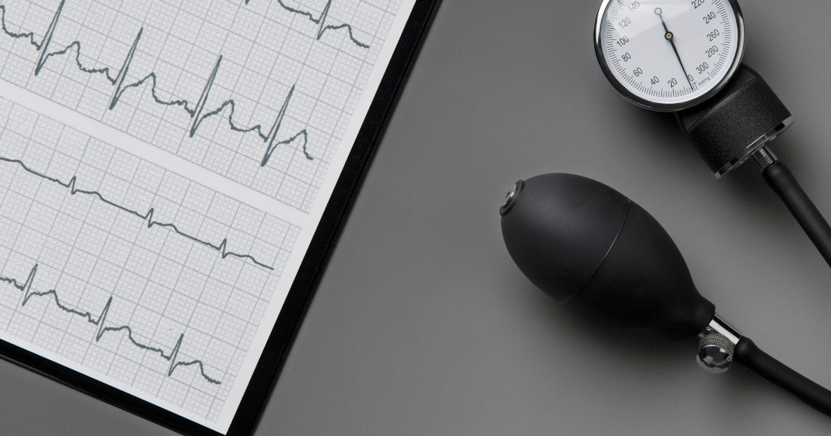 laudo de exame ecg