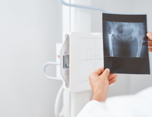 Entrega de laudos atrasada: 3 passos simples para reduzir o tempo de espera do paciente